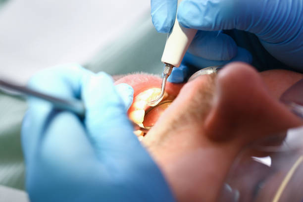 Best Emergency Treatment for Dental Infections or Abscesses in Cementon, PA