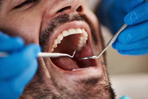 Best Urgent Care for Lost Fillings or Crowns in Cementon, PA